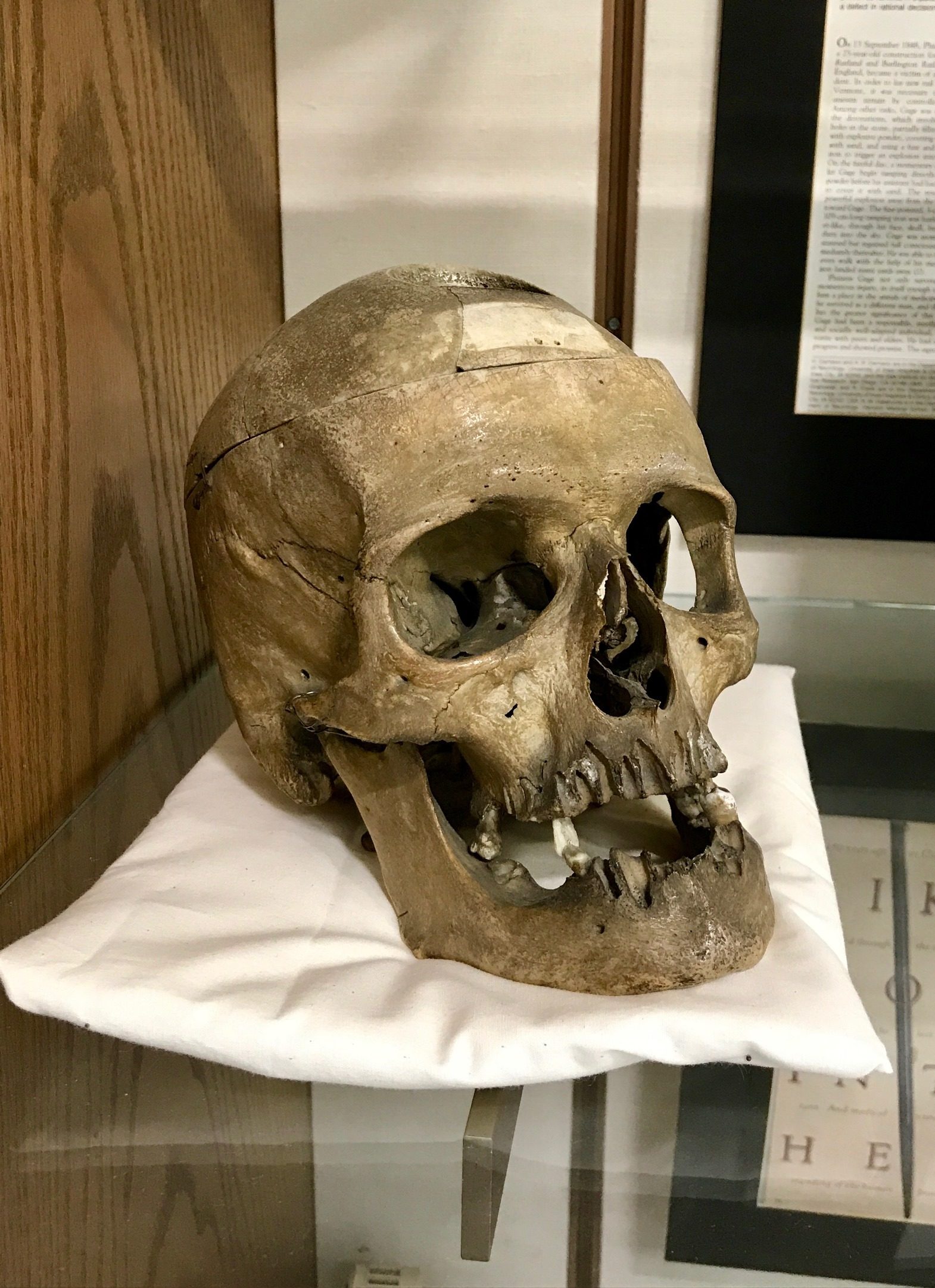Phineas Gage memorabilia, Warren Anatomical Museum, Boston (by Luca Ambrosio) - 07.jpg